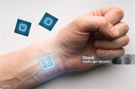 rfid chip in hand|chip implant in hand switzerland.